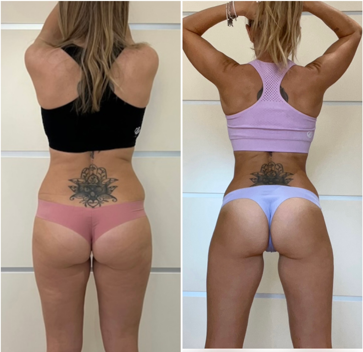 Transformation 2